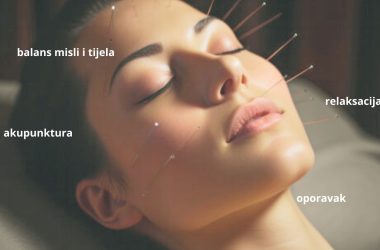 lice žene s akupunkturnim iglama