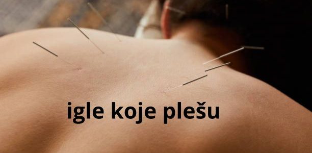 leđa djevojke sa akupunktunim iglama