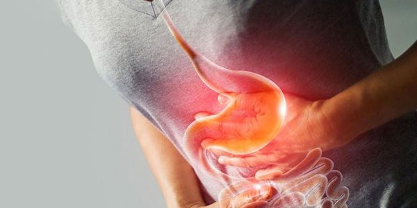 gastritis