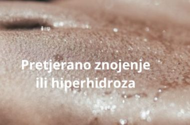 pretjerano znojenje