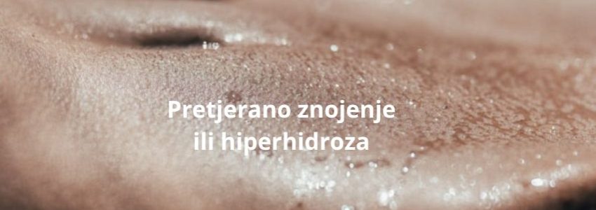 pretjerano znojenje